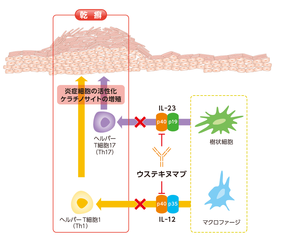ウステキヌマブ「F」のヒトIL-12及びIL-23に対する作用機序［皮膚］